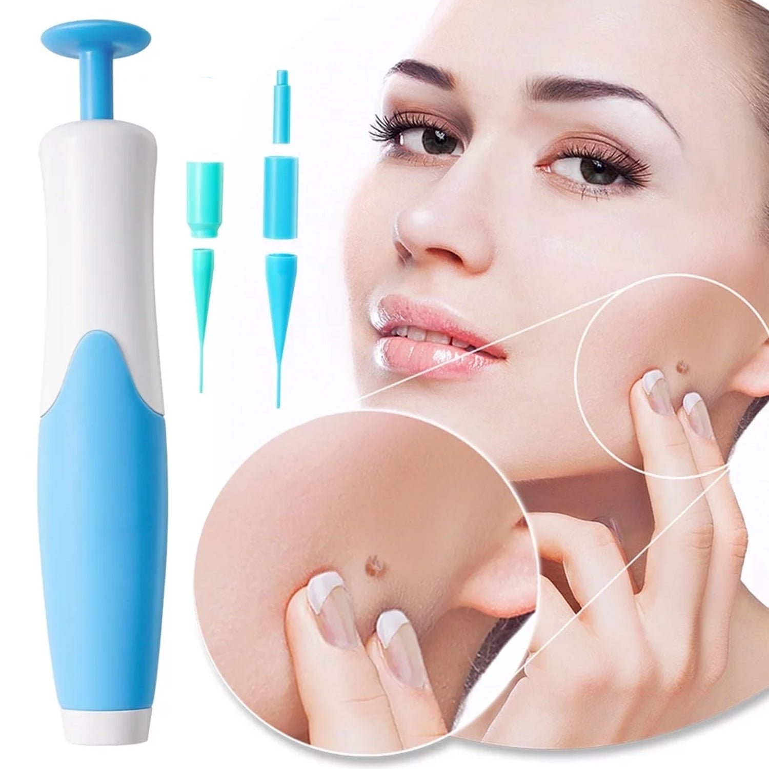 Skin Tag Remover Kit 2 in 1 for Micro to Large (2 mm - 8 mm / 1 Set) - Image 3